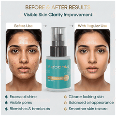 Sebonia Serum 20Ml Sebonia Serum 20Ml