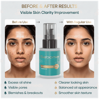 Sebonia Serum 20Ml