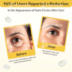 Eyecirque Under Eye Gel Serum 30gm