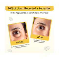 Eyecirque Under Eye Gel Serum 30gm