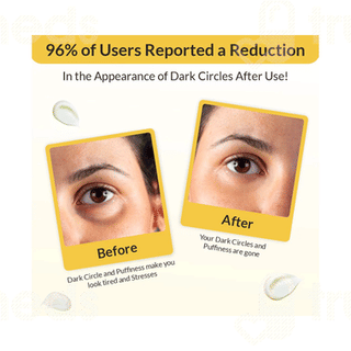 Eyecirque Under Eye Gel Serum 30gm