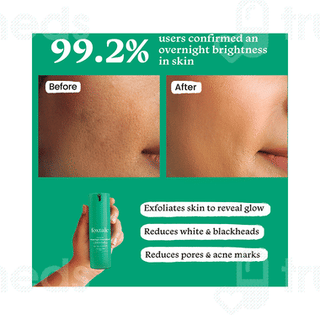 Foxtale The Diva Overnight Glow Mask 30 ML