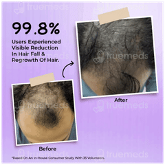 Baksons Hair Reviver 100Ml