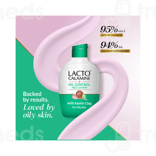 Lacto Calamine Oil Balance With Aloe Vera Lotion 30ml