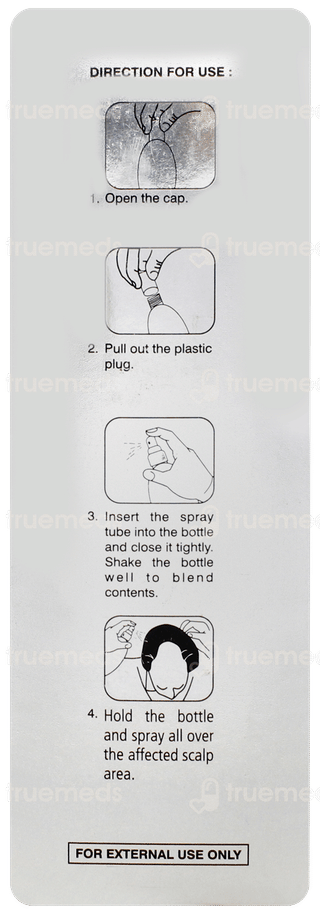 Topgain 2% Solution 60ml