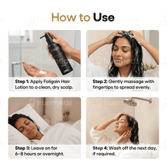 Foligain Hair Lotion 100Ml