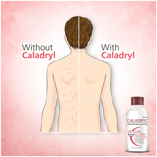 Caladryl Skin Soothing Solution 65ml