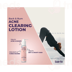 Sanfe Back & Bum Acne Clearing Lotion 100ml