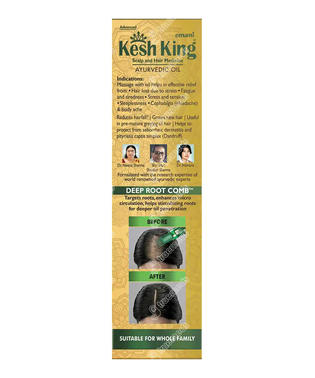Kesh King Oil 100 ML
