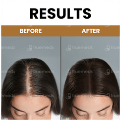 Myupchar Ayurveda Kesh Art Intensive Hair Oil 100ml