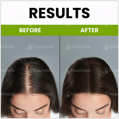 Myupchar Ayurveda Rosemary Essential Oil 15ml