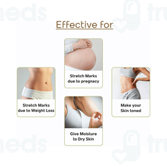 Mother Sparsh Stretch Mark Massage Oil 100ml