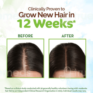 Mamaearth Rosemary Hair Growth Oil 150Ml