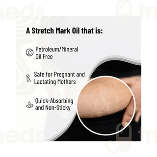 Chemist At Play Stretch Marks And Scar Fading Oil 50ml