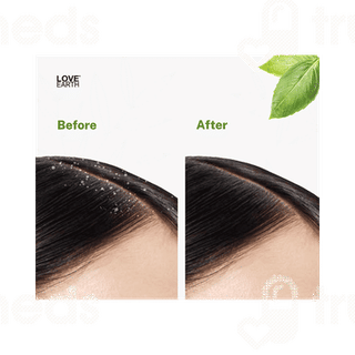 Love Earth Organic Neem Oil 100ml
