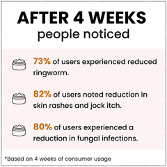 Myupchar Ayurveda Maha Marichyadi Ointment 50gm