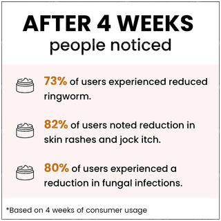 Myupchar Ayurveda Maha Marichyadi Ointment 50gm