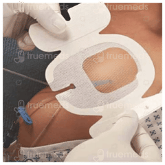 3M Tegaderm Chg 1657R 8.5Cm X 11.5Cm Dressing 1
