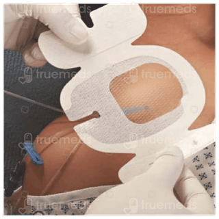 3M Tegaderm Chg 1657R 8.5Cm X 11.5Cm Dressing 1