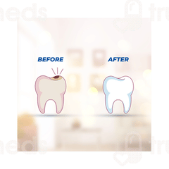Smyle Herbal Paste 100 Gm