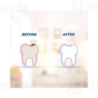 Smyle Herbal Paste 100 Gm