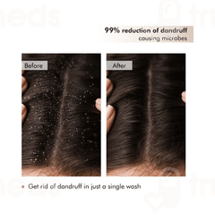 Mcaffeine Naked & Raw Coffee Scalp Scrub 250gm
