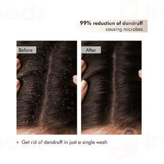 Mcaffeine Naked & Raw Coffee Scalp Scrub 250gm