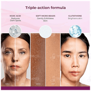 Kozicare Skin Lightening Scrub 100gm