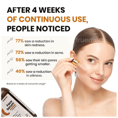 Myupchar Reduces Acne & Blemishes Face Serum 50ml