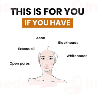 Myupchar Reduces Acne & Blemishes Face Serum 50ml