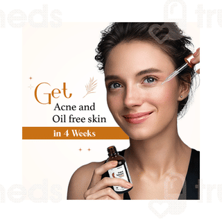 Myupchar Reduces Acne & Blemishes Face Serum 50ml