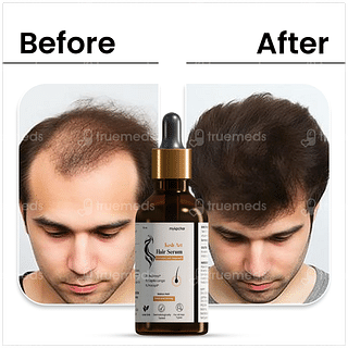 Myupchar Kesh Art Hair Serum 50ml