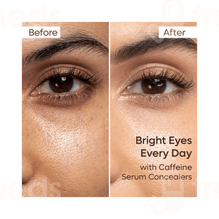 Mcaffeine Eyes On You Serum Concealer 5ml