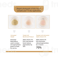 Vandyke Alpha Arbutin 02% Face Serum 30ml