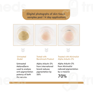 Vandyke Alpha Arbutin 02% Face Serum 30ml