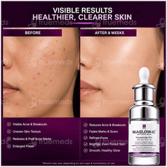Niaglow 10 Skin Refining Serum 30Ml