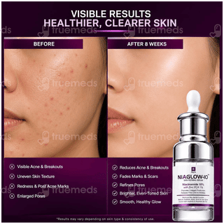 Niaglow 10 Skin Refining Serum 30Ml