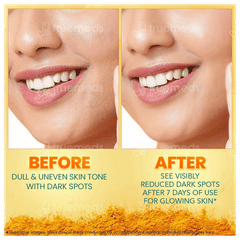Himalaya Dark Spot Clearing Turmeric Face Serum 15Ml