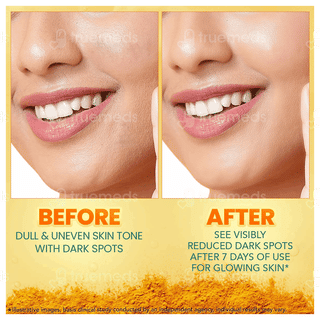 Himalaya Dark Spot Clearing Turmeric Face Serum 15Ml