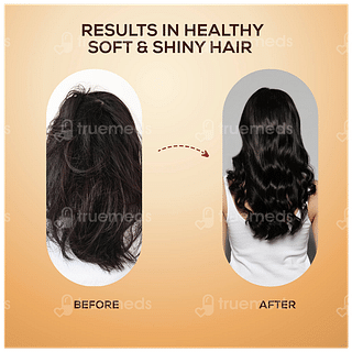 Ayouth Veda Anti Hairfall Tonic 100ml