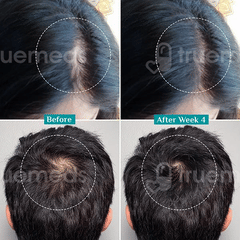 Pilgrim New & Improved Advanced Hair Growth Serum 50Ml