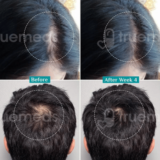 Pilgrim New & Improved Advanced Hair Growth Serum 100Ml