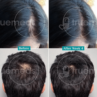 Pilgrim New & Improved Advanced Hair Growth Serum 30Ml