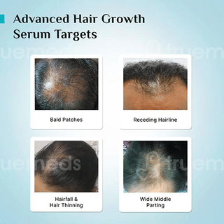 Pilgrim New & Improved Advanced Hair Growth Serum 30Ml