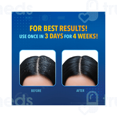 Scalpe+ Shampoo 75ml Scalpe+ Shampoo 75ml