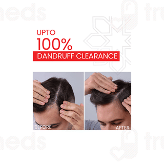 Lupizol Zs Shampoo 100ml