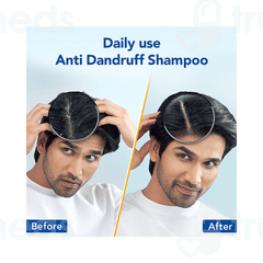 Scalpe Pro Daily Anti Dandruff Shampoo 200ml