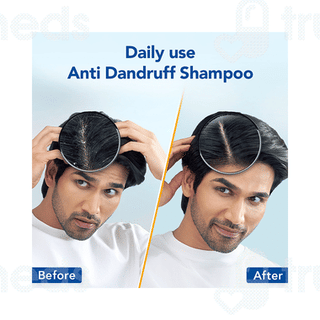 Scalpe Pro Daily Anti Dandruff Shampoo 200ml