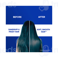 Head & Shoulders Anti Dandruff Smooth & Silky Shampoo 340ml