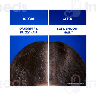Head & Shoulders Anti Dandruff Smooth & Silky Shampoo 340ml